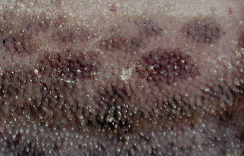 Unidentified Discodorid #5: notum detail