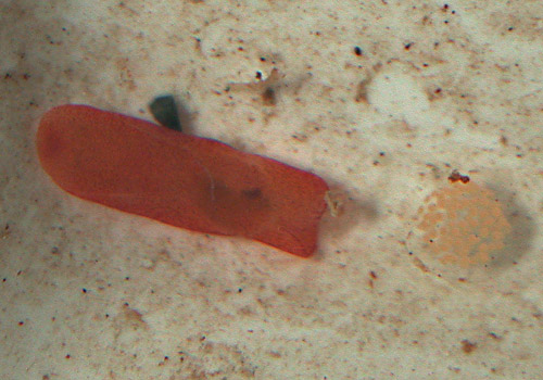 Philine rubrata: with egg mass