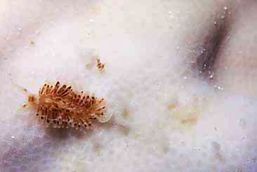 Tenellia poritophages